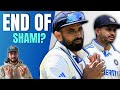 Is this end of Shami? 🥹😟 India Squad for England 2025