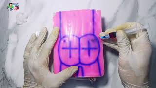 Doctors Say NEVER Inject Here 😱💉 | Safe IM Technique Explained