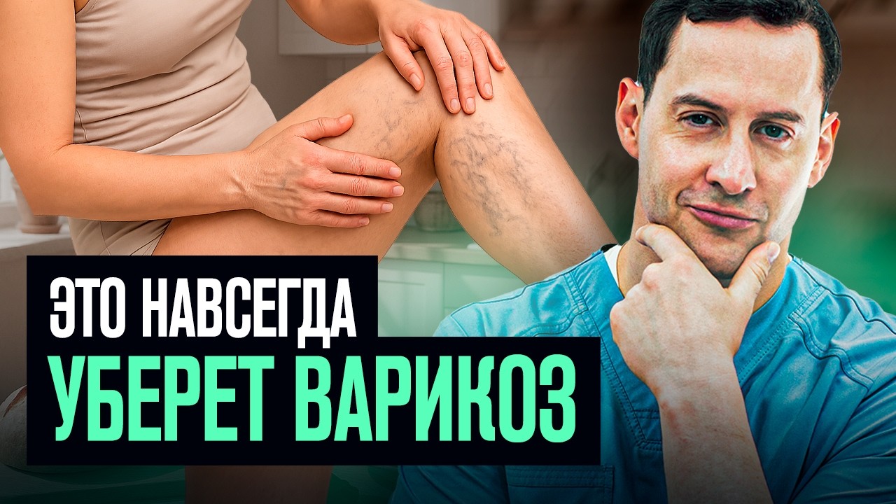 Варикоз исчезнет за неделю? Разбираю ТОП 5 средств от сосудистой сетки