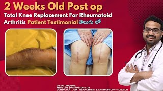 2 Weeks Old Post op Total Knee Replacement For Rheumatoid ArthritisPatient Testimonial తెలుగు లో