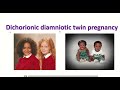 Anatomy of dichorionic and diamniotic twin pregnancy with sonographic features