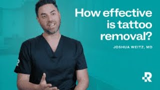 How Effective is Tattoo Removal?