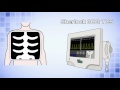 Comparison of chest xray and sherlock 3cg tcs  abstract 121230