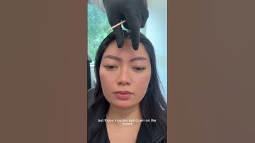 First time getting Botox at Texas Facial Aesthetics! ✨