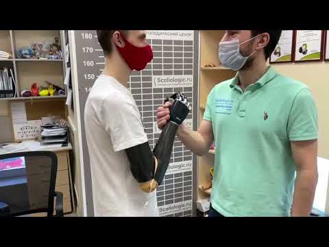 Scoliologic bebionic Ottobock. 1