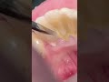 #reels #dental #dentalcare #viralvideo #newaccount #amaxing #dentalhealth