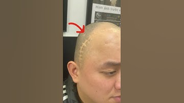 Sức mạnh của Nghệ thuật tạo hình xăm tóc, tạo chân tóc 3D , Điêu khắc sợi siêu thực , khắc sợi tóc.