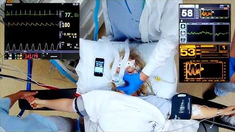 BIS response to suxamethonium paralysis in an awake volunteer