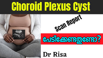 Choroid Plexus Cyst Malayalam | Anomaly Scan Report