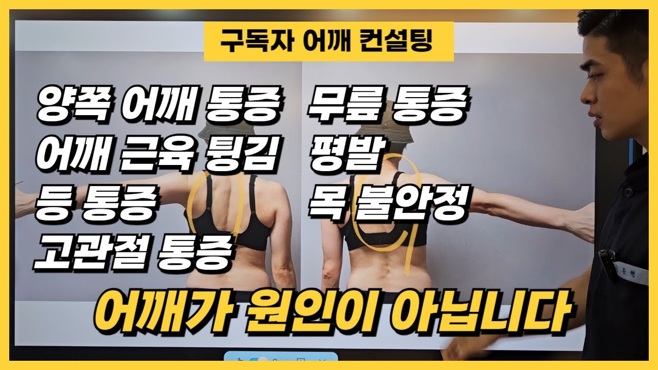 [구독자 어깨 컨설팅] 어깨가 아프지만 어깨가 원인이 아닙니다
