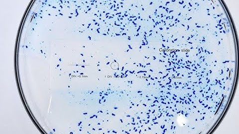 How to analyze particles on ImageJ FIJI