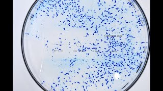 How to analyze particles on ImageJ FIJI