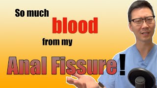 2 reasons why your Anal Fissures bleed so much!