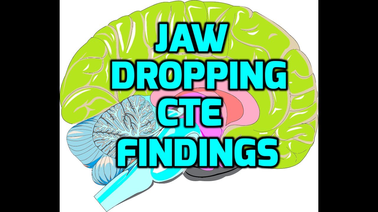 camera iphone 8 plus apk 110 Of 111 NFL Brains Found To Have CTE