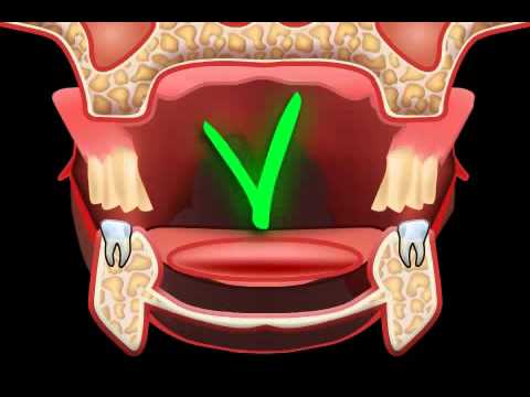 Denture Problems - what can you do?