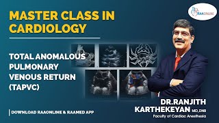 Total anomalous pulmonary venous connection (TAPVC) - Master Class in Cardiology