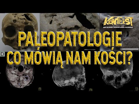 Paleopatologie. Co mówią nam kości? - Barbara Kwiatkowska, Aleksandra Karykowska | KONTEKST 14