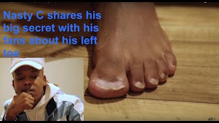 Nasty C shares his big secret with his fans about his left toe
