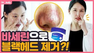 [SUB] 바세린 Vaseline으로 블랙헤드 제거? 진실 혹은 