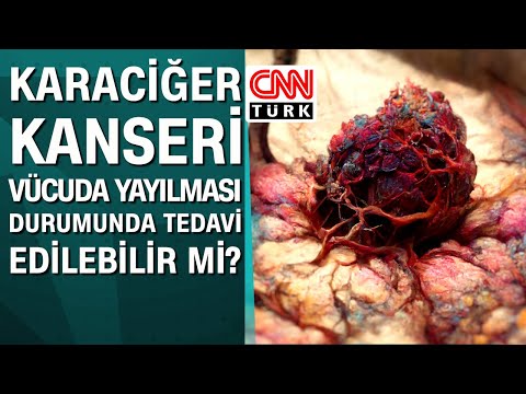 Video: Kedilerde Kanser: Üç Tedavi Seçeneği