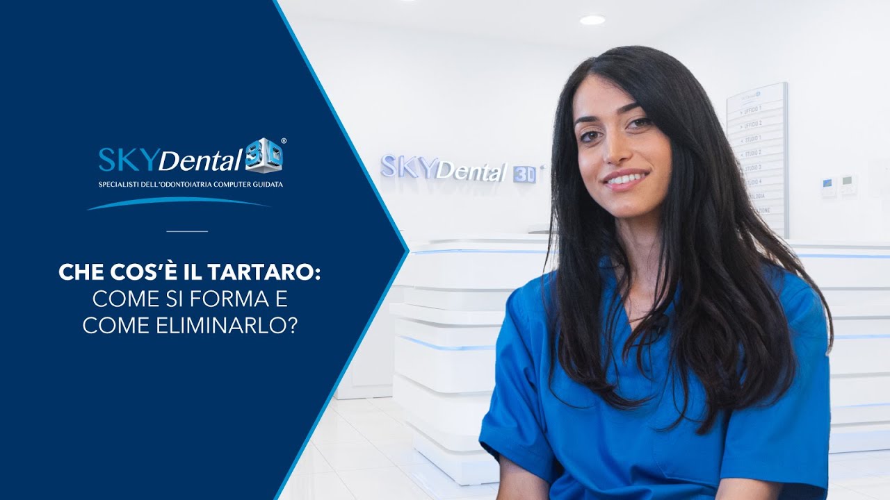 Che cos'è il TARTARO, come si forma e come eliminarlo - SkyDental 3D