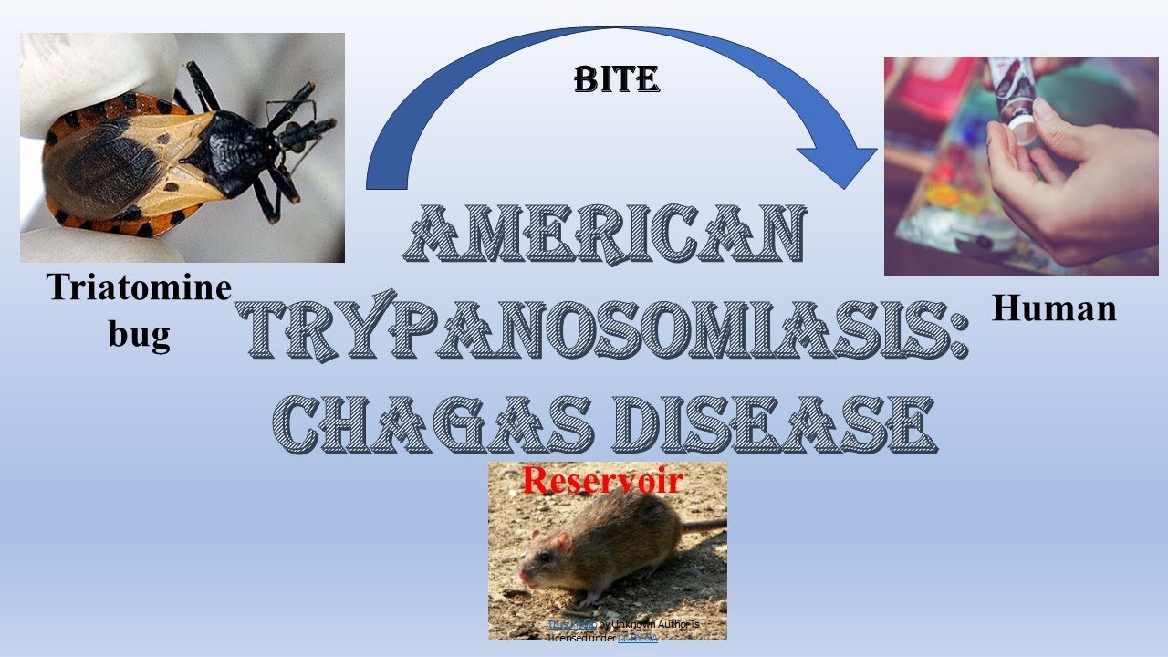Chagas disease I Trypanosoma cruzi I American trypanosomiasis I Reduviid bug I Triatomine bug I