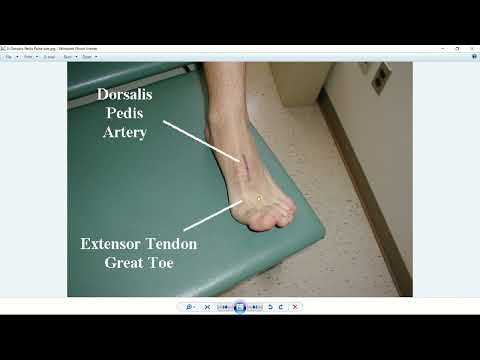 معاینه نبض های بدن