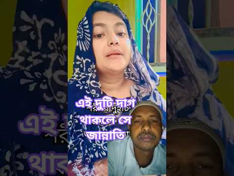 🎤@##shortsvideo যাদের শরীরে এই দুটি দাগ আছে তারা জান্নাতি#@🎤