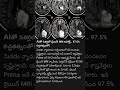 MRI Scan #ai #technology #health #viralshort #famousshorts