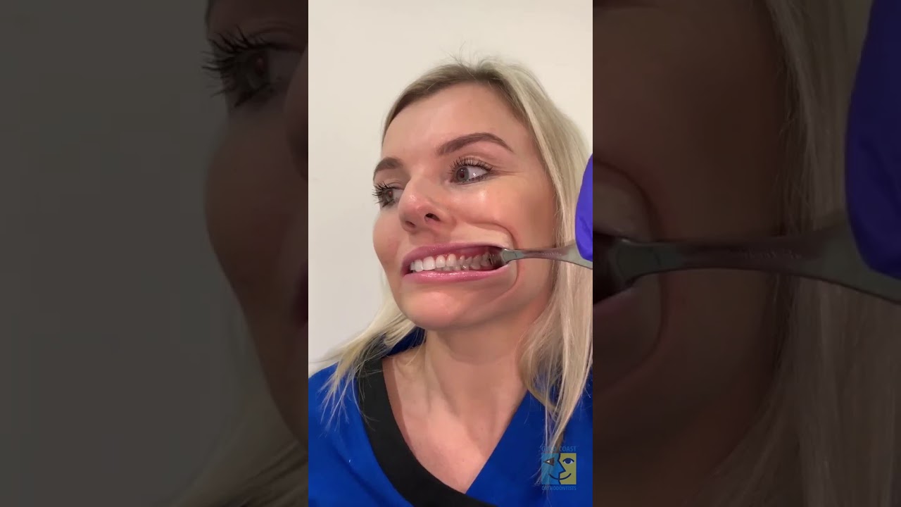 How To Take Intra Oral Photos Guide