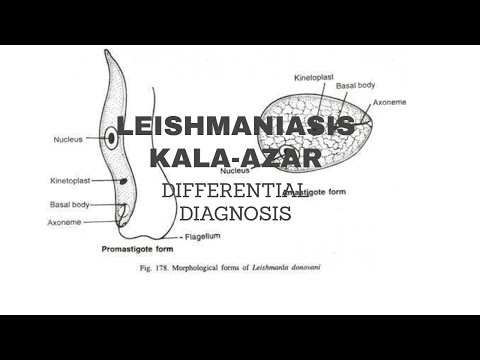 Video: Leishmaniasis - Gejala, Jenis, Diagnosis, Rawatan