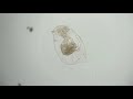 ゾウリムシを次々と捕食するフクロワムシ