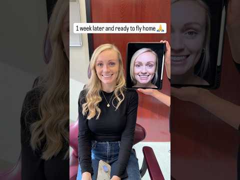 Video thumbnail: #closedrhinoplasty #naturalbeauty #nosejob #rhinoplasty #scarlessnose #bestrhinoplastysurgeon · Dr. Deepak Dugar | Scarless Nose Rhinoplasty