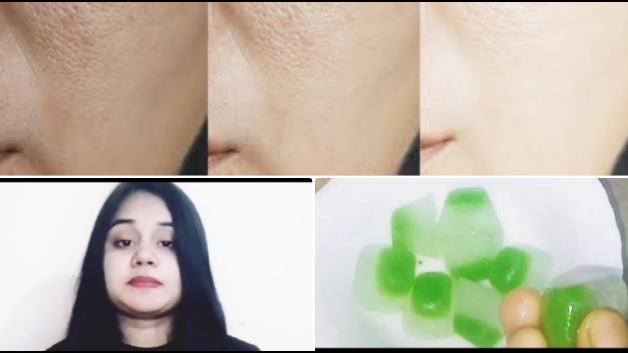Apply Ice Cube on face for glowing skin| Rub 1 ice cube daily & see the magic