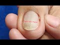 Pedicure May 3 #satisfying Neldz SOLO Parent  is live!