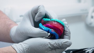 NextDent Workflow Dentures Intra Oral Scanning