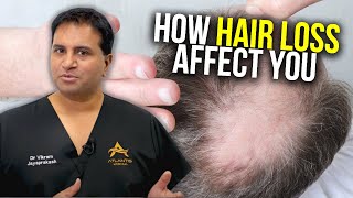 The Mental and Psychological Effects of Hair Loss | The Hair Loss Show