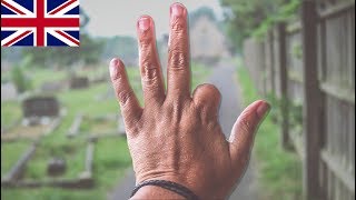 HOW I LOST MY FINGER?!