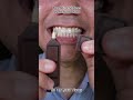Satisfying Chewing ASMR #Compilation #ASMR #DoctorTristanPeh