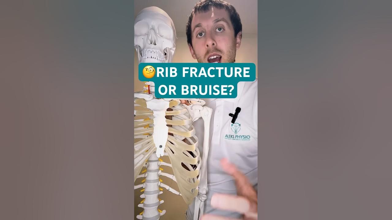 broken-rib-or-bruised-rib-how-to-tell-the-difference-youtube