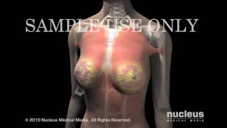 Breast Cancer: Anatomy of the Breast