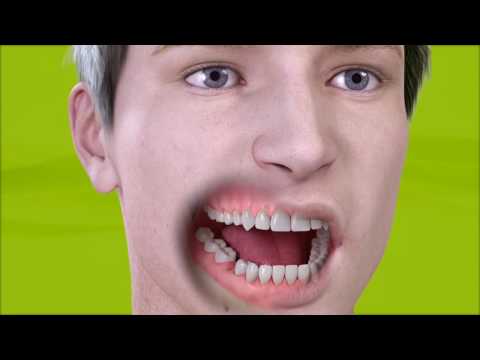 Video: Miksi Hampaiden Vetäminen Ei Ole Kuin Niiden Purkaminen