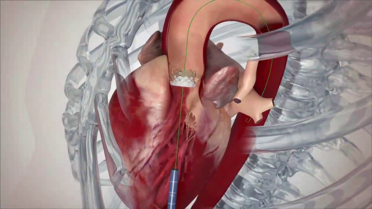 TAVIアニメーション - YouTube