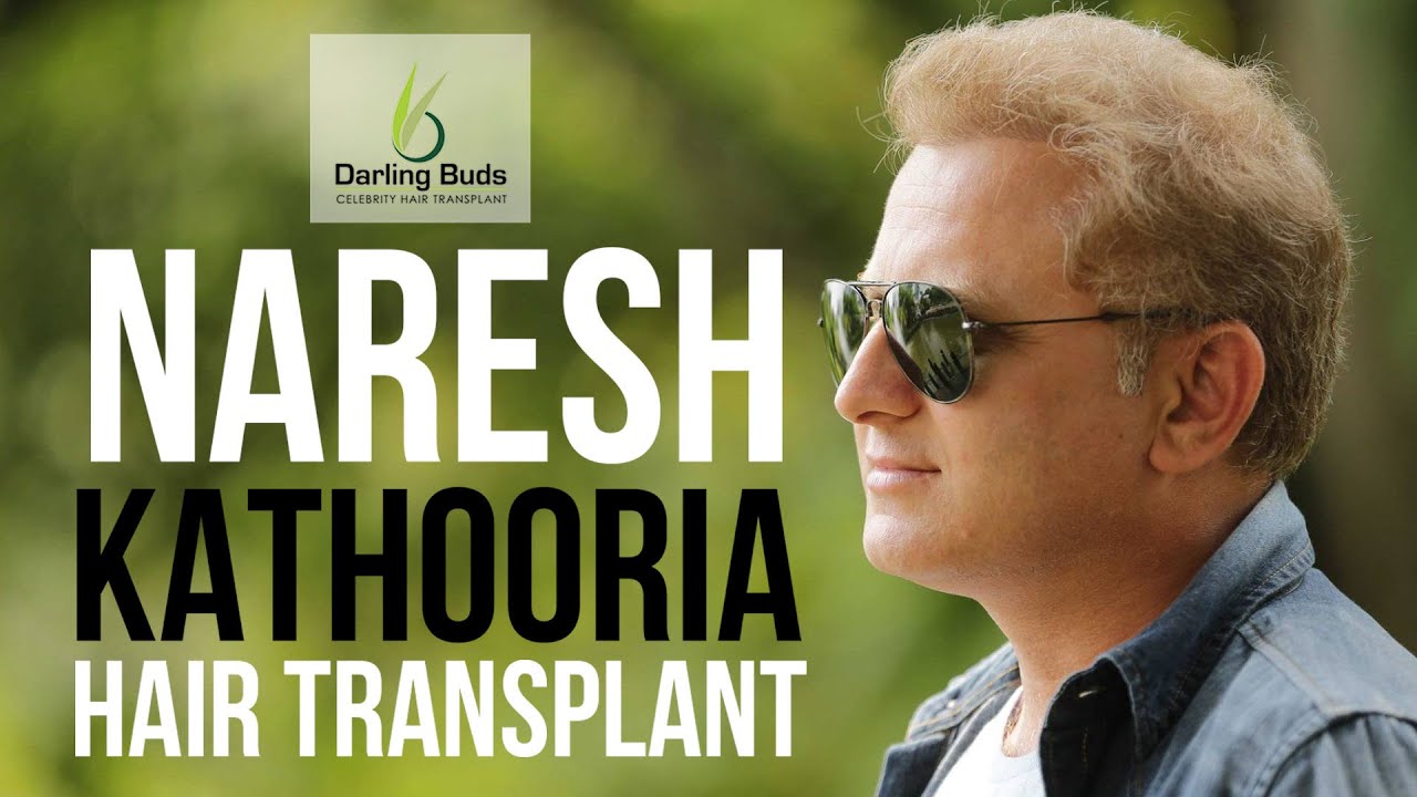 Naresh Kathooria Hair Transplant | Darling Buds,Chandigarh - YouTube