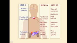 Endocrinology Review Questions - CRASH! Medical Review Series