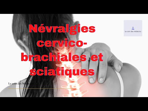 Vidéo: Radiculite De La Colonne Cervicale (sciatique Cervicale)