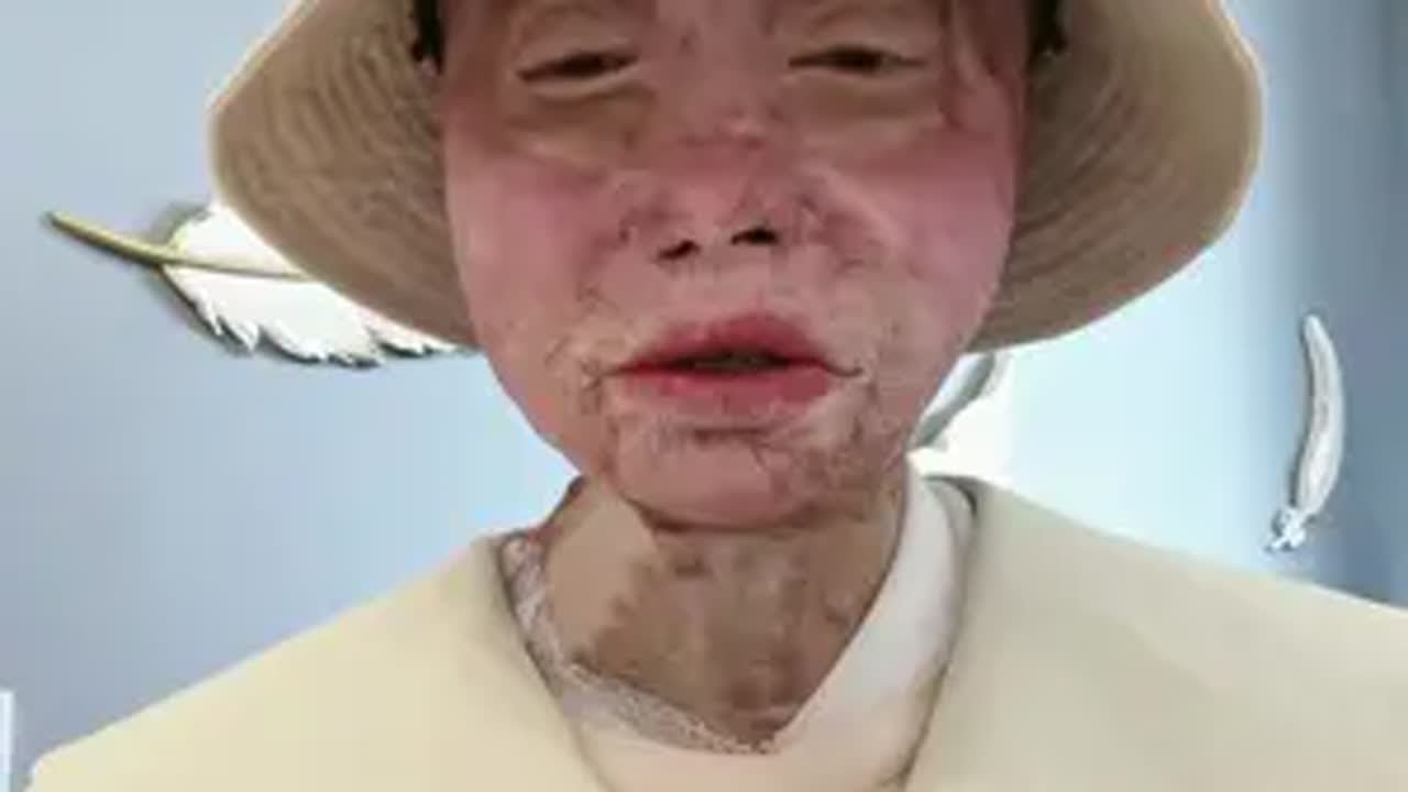 四川乐山烧伤女孩乔燕 当事人在抖音