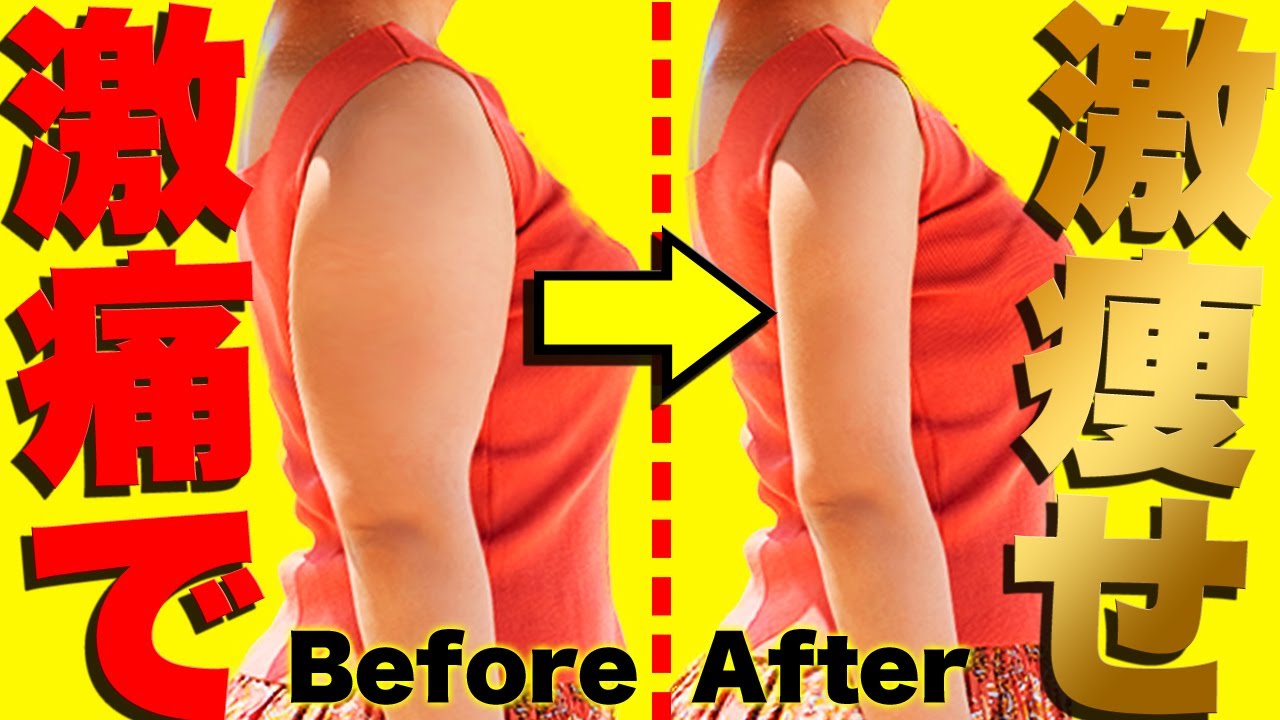 Верхняя рука Липосакция Верхняя рука тонкая рука тонкая провисание