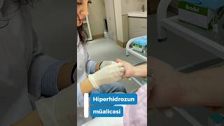 Əl içi aşırı tərləmənin müalicəsi #dermatologist #dermatology #baki #hiperhidrosis #cosmetology