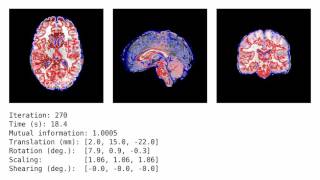 Medical image registration